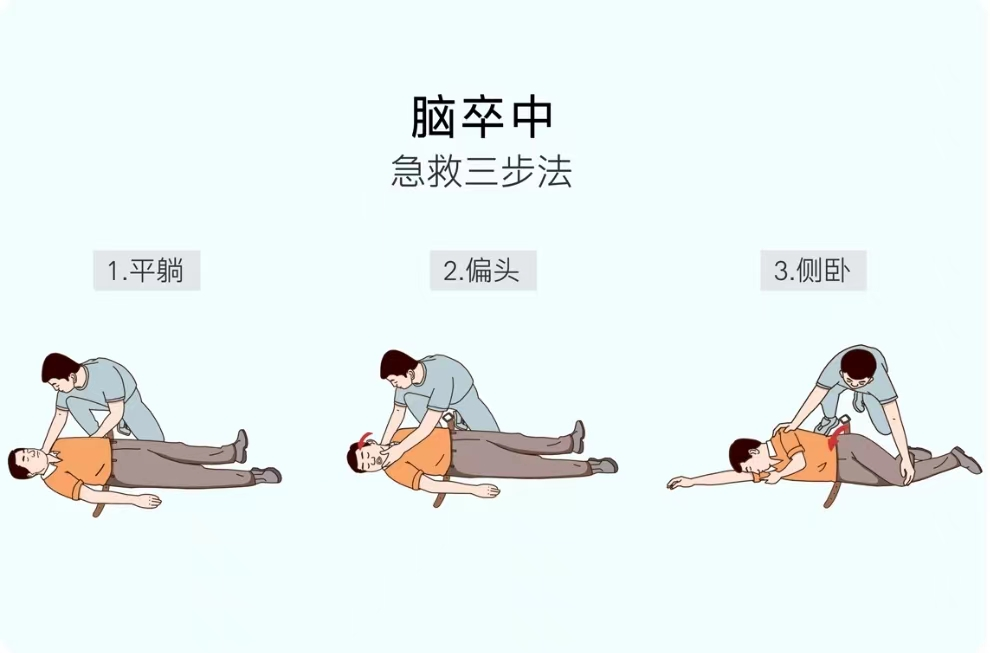 【健康科普】關(guān)于腦卒中，你了解